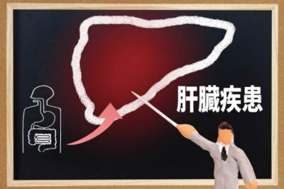 肝機能障害の初期症状とは？気になるサインと早期発見の大切さのアイキャッチ画像