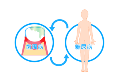【肝臓病専門医が解説】歯周病が糖尿病・肝臓にも悪影響！？知っておきたい「口腔と肝臓」の深い関係のアイキャッチ画像