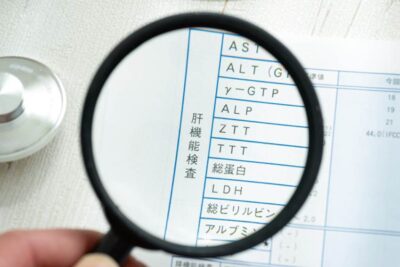 AST、ALT、γ-GTP ～ あなたの数値は大丈夫？肝機能検査で見るべきポイントのアイキャッチ画像