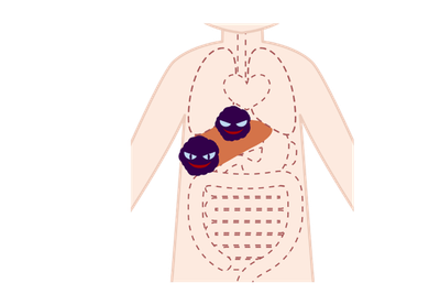 肝細胞がんの最新免疫療法:アテゾリズマブ+ベバシズマブとコンバージョン手術の最前線のアイキャッチ画像