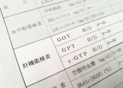 【専門医が徹底解説】放置は禁物！肝硬変が招く肝がんリスクと、その前に知っておくべきことのアイキャッチ画像