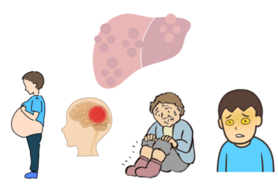 進行した肝不全でも諦めない！ さいとう内科クリニックの肝臓再生医療のアイキャッチ画像