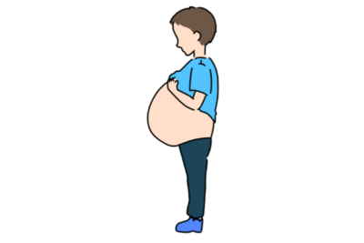 お腹の膨らみは「腹水」かも？肝硬変で腹水が溜まる原因と治療法のアイキャッチ画像