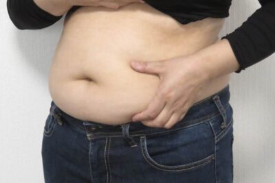 【肝臓病専門医が解説】「脂肪肝」は命に関わる万病の元！「太っているだけ」と放置するのは危険な理由のアイキャッチ画像