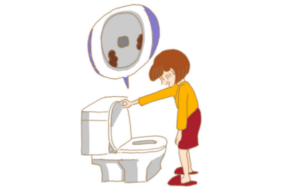 【危険なサイン】「うんちが白い!」便の色でわかる肝臓・胆のうからのSOSのアイキャッチ画像