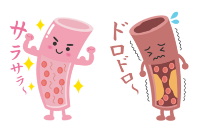 【放置すると動脈硬化へ】血液を「ドロドロ」に汚す!脂肪肝の恐怖と簡単な改善策のアイキャッチ画像